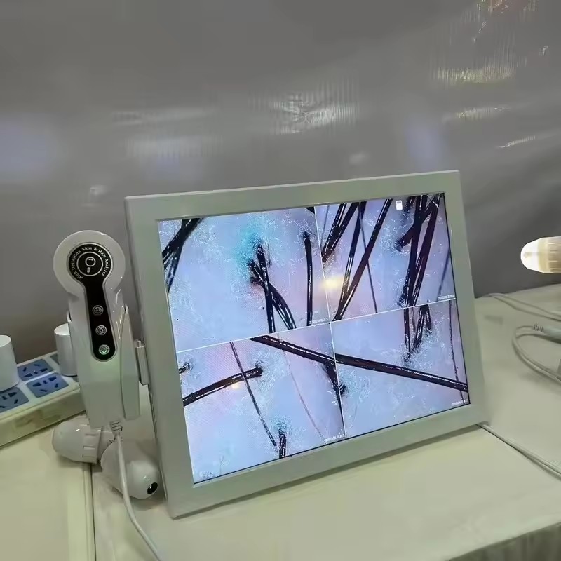 HD Digital Skin Analyzer Profe - Skin Moisture Analyzer Digital Detector 评论和价格