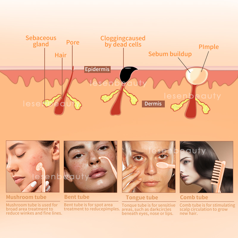 Darsonval New High Frequency F - High Frequency Wand Facial Machine Neon 评论和价格