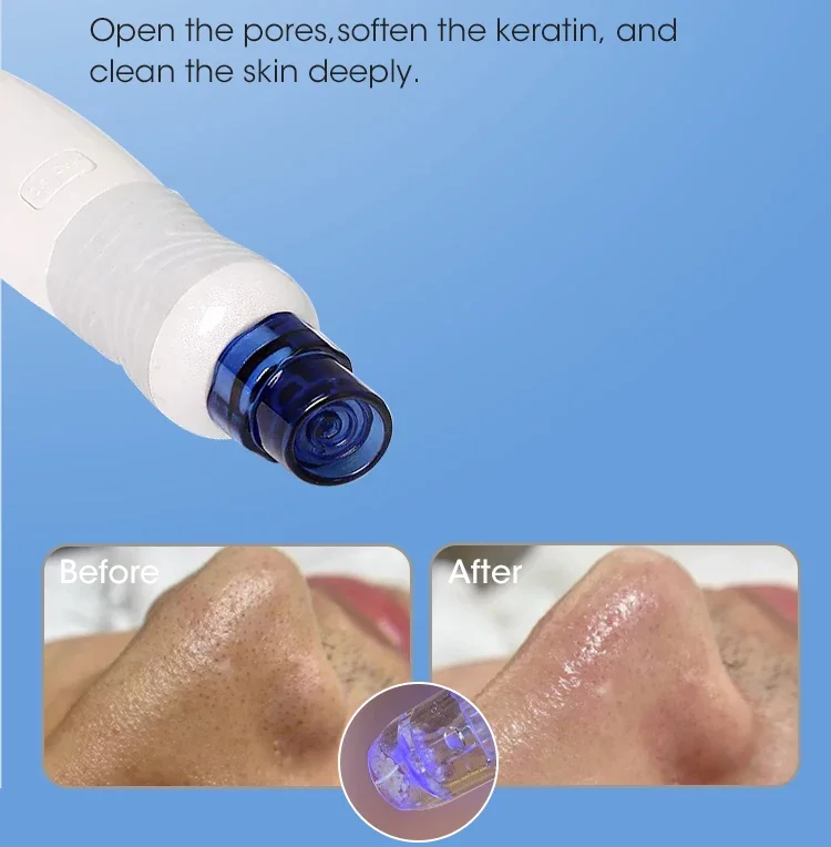 Hot Selling Spa Use Hydroderma - Hydro Facial Machine 7 In 1 评论和价格