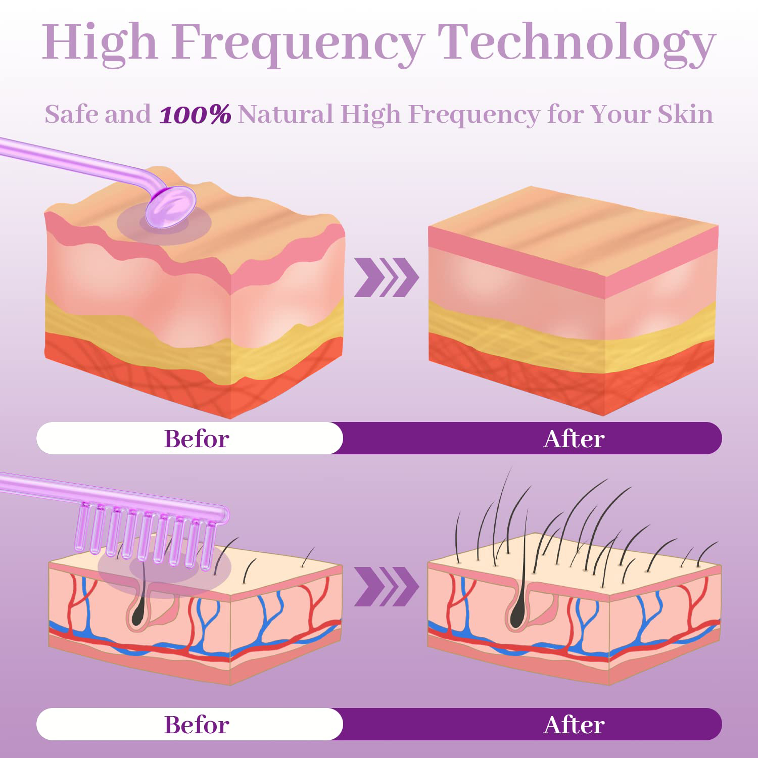 4in1 High Frequency Electrode  - High Frequency Wand Facial Machine Neon 评论和价格