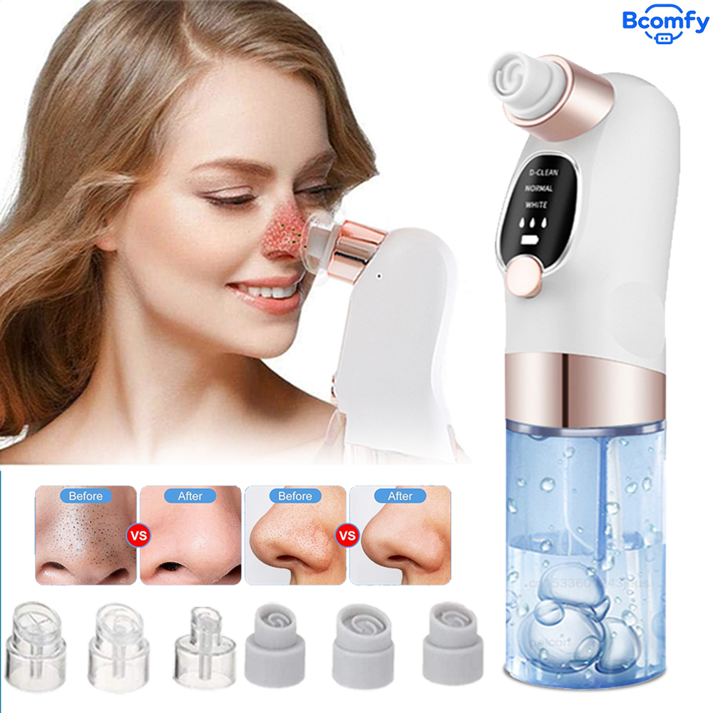 Electric Blackhead Remover Vac - Blackhead Remover Vacuum Suction 评论和价格