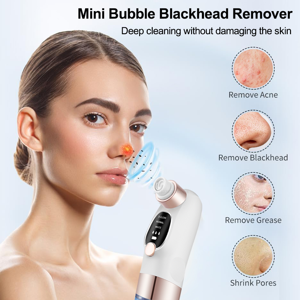 Electric Blackhead Remover Vac - Blackhead Remover Vacuum Suction 评论和价格