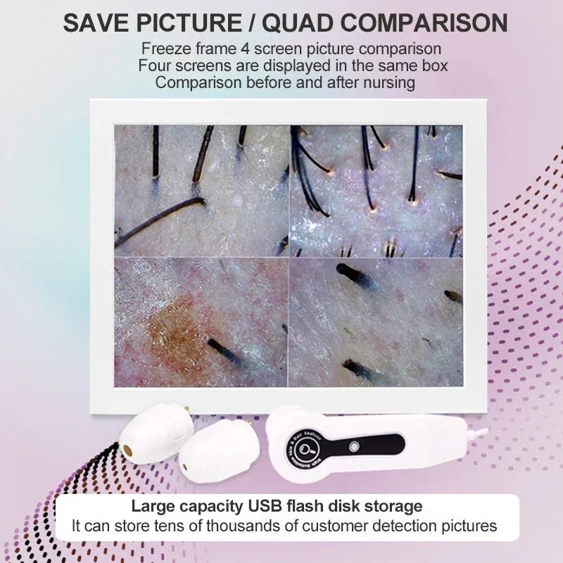 2025 HD Digital Skin Analyzer  - Skin Moisture Analyzer Digital Detector 评论和价格