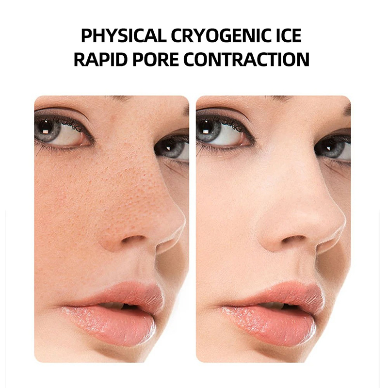 Hot Cold Hammer Home Facial Ma - Cold Warm Hammer Facial Machine 评论和价格