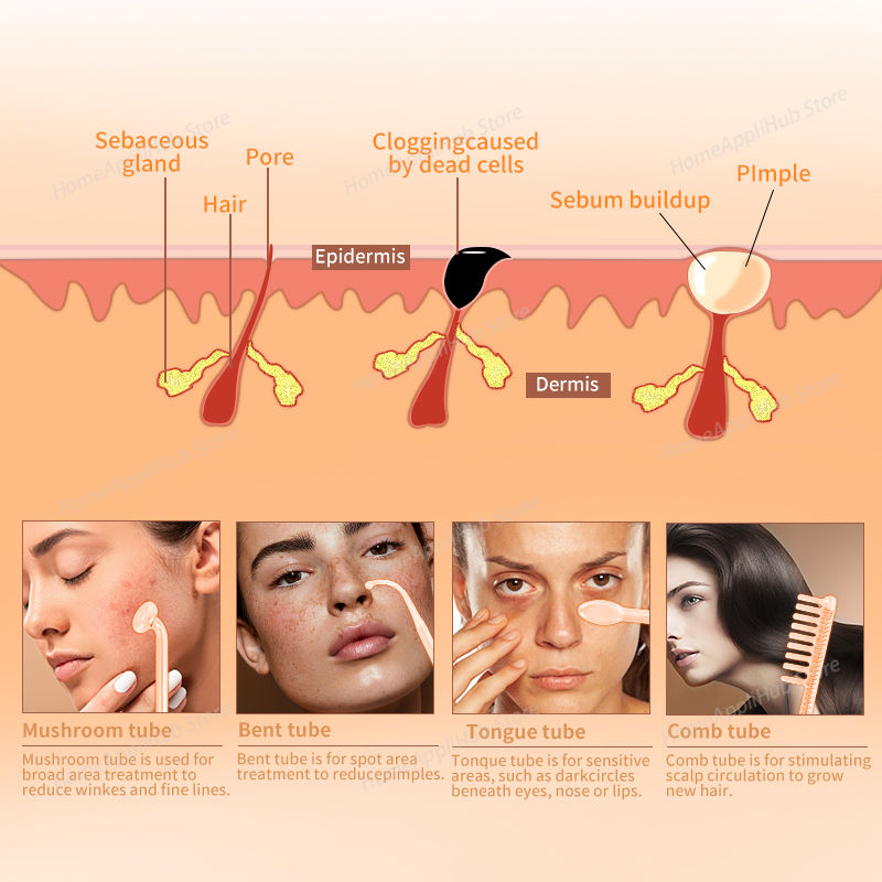 Darsonval Portable High Freque - High Frequency Wand Facial Machine Neon 评论和价格
