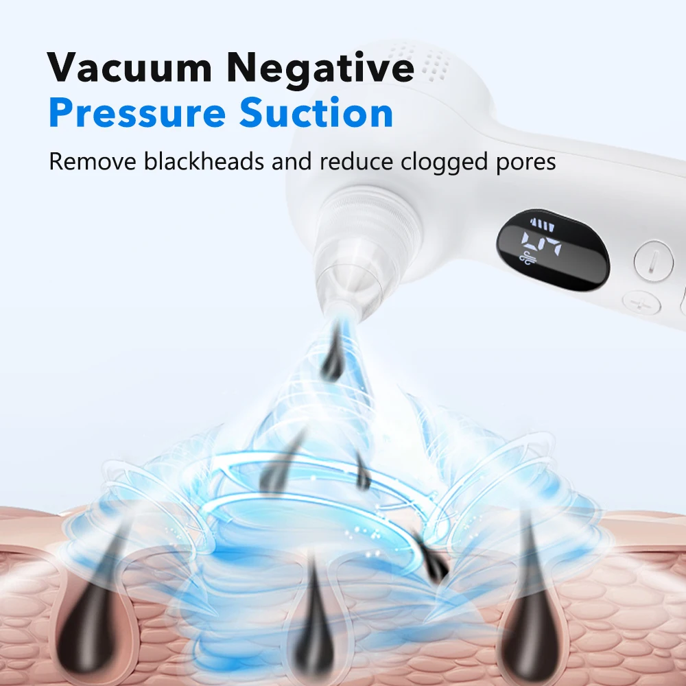 Blackhead Remover Pore Vacuum  - Blackhead Remover Vacuum Suction 评论和价格