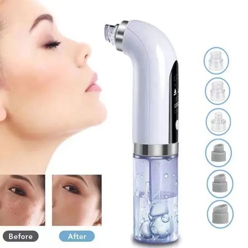 Deep-cleaning handheld blackhe - Blackhead Remover Vacuum Suction 评论和价格