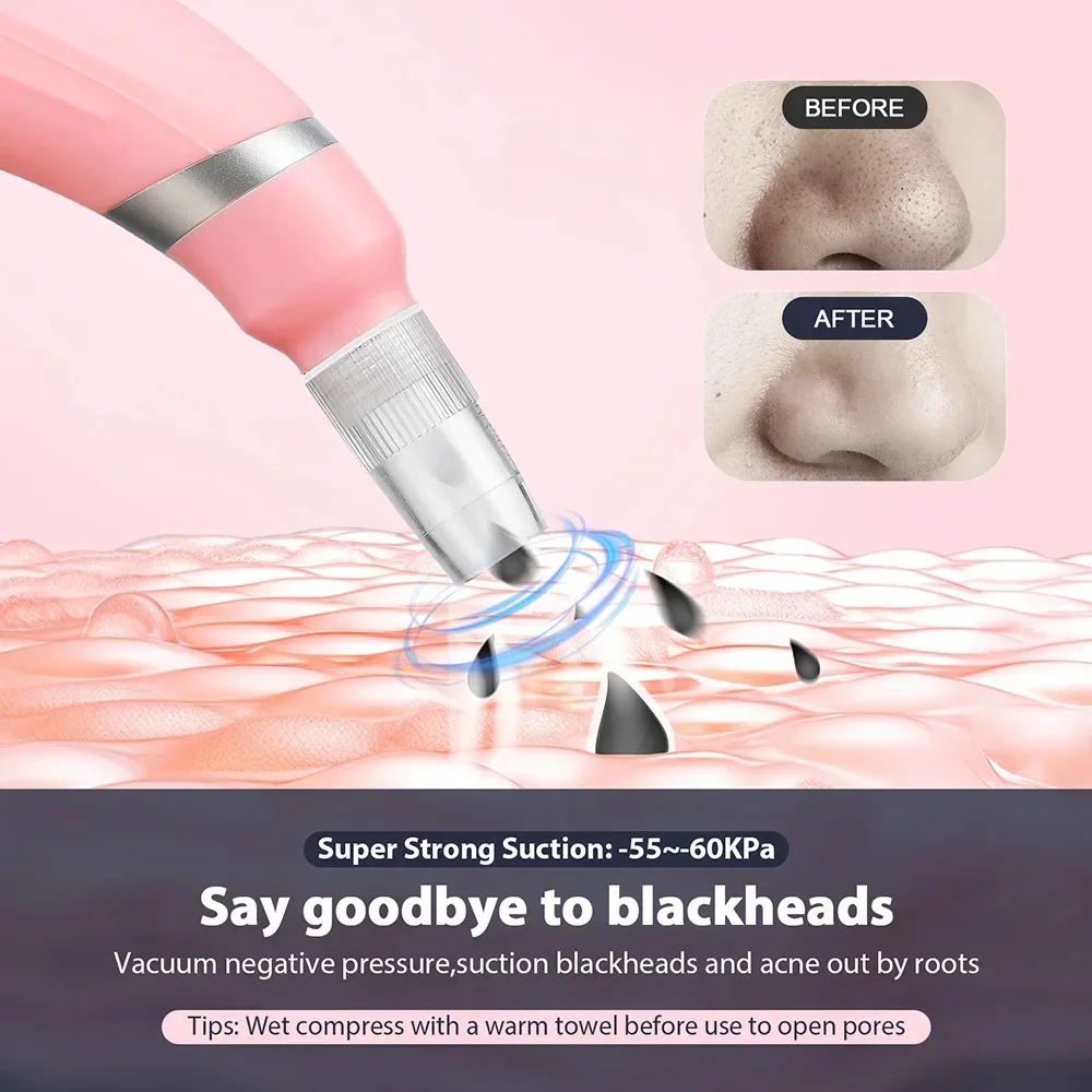 2 In 1 Diamond Microdermabrasi - Diamond Microdermabrasion Machine 3 In 1 评论和价格