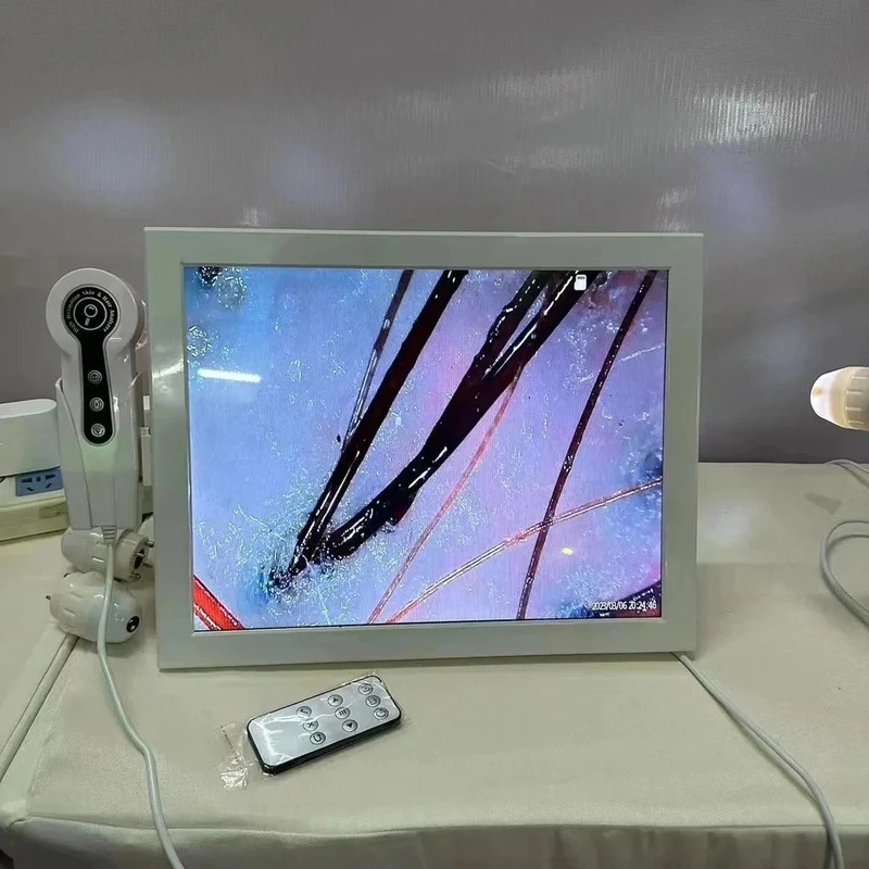 2025 HD Digital Skin Analyzer  - Skin Moisture Analyzer Digital Detector 评论和价格