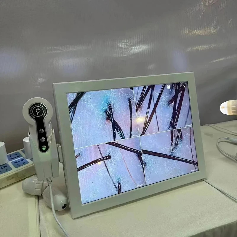 2025 HD Digital Skin Analyzer  - Skin Moisture Analyzer Digital Detector 评论和价格