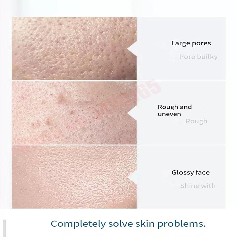 Hydra Serum Solution Facial De - Hydra Dermabrasion Aqua Peel Machine 评论和价格