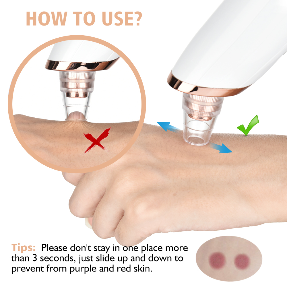 Blackhead Remover Vacuum Pore  - Blackhead Remover Vacuum Suction 评论和价格