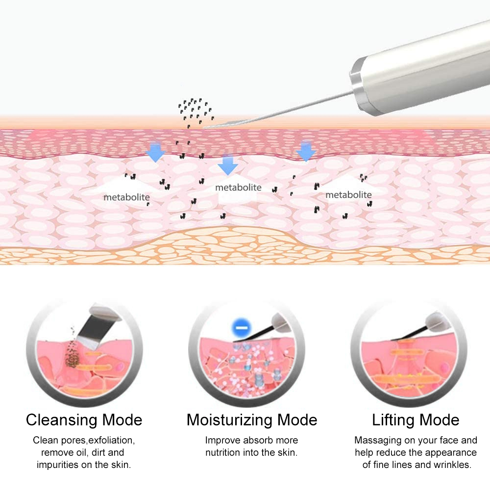 Ultrasonic Skin Scrubber & Vac - Blackhead Remover Vacuum Suction 评论和价格