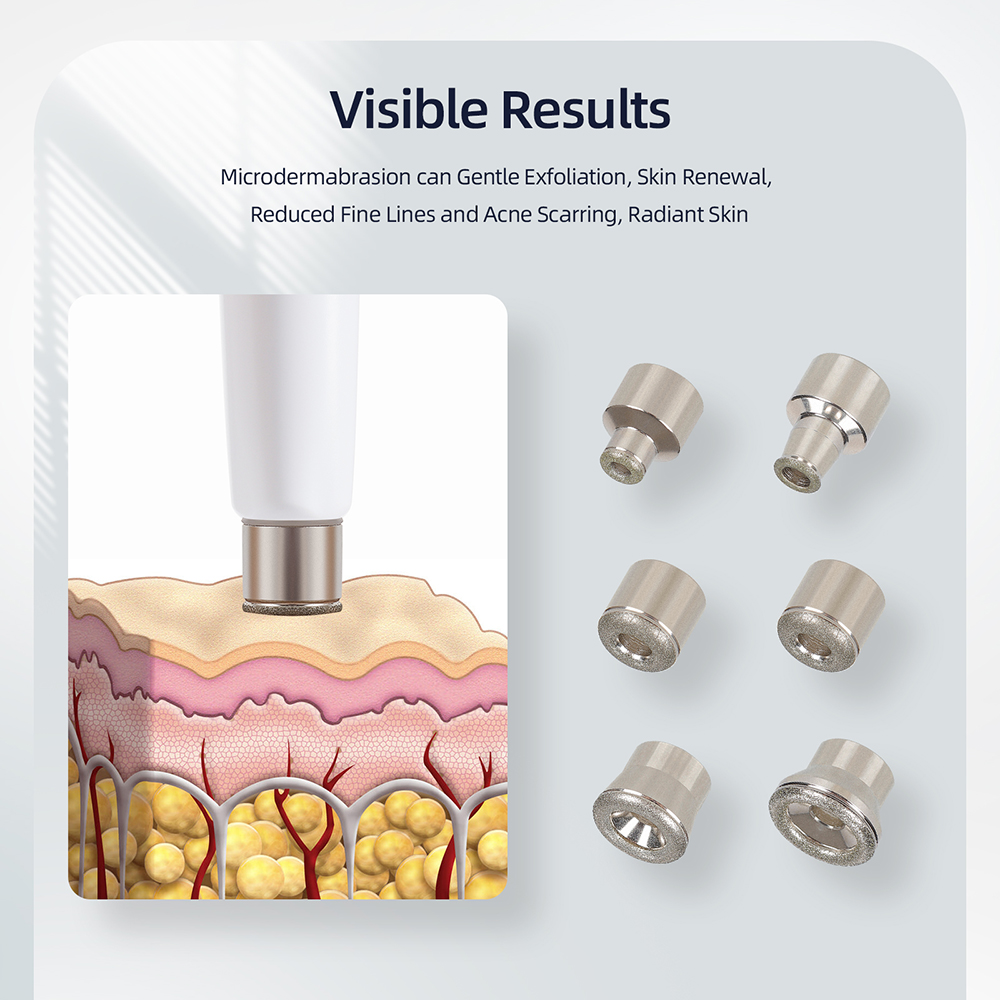 3-in-1 Diamond Microdermabrasi - Diamond Microdermabrasion Machine 3 In 1 评论和价格