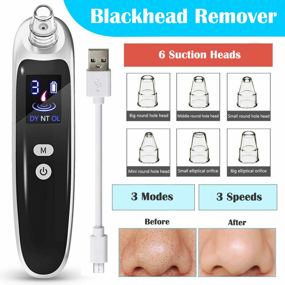 Electric Blackhead Remover Dee - Blackhead Remover Vacuum Suction 评论和价格