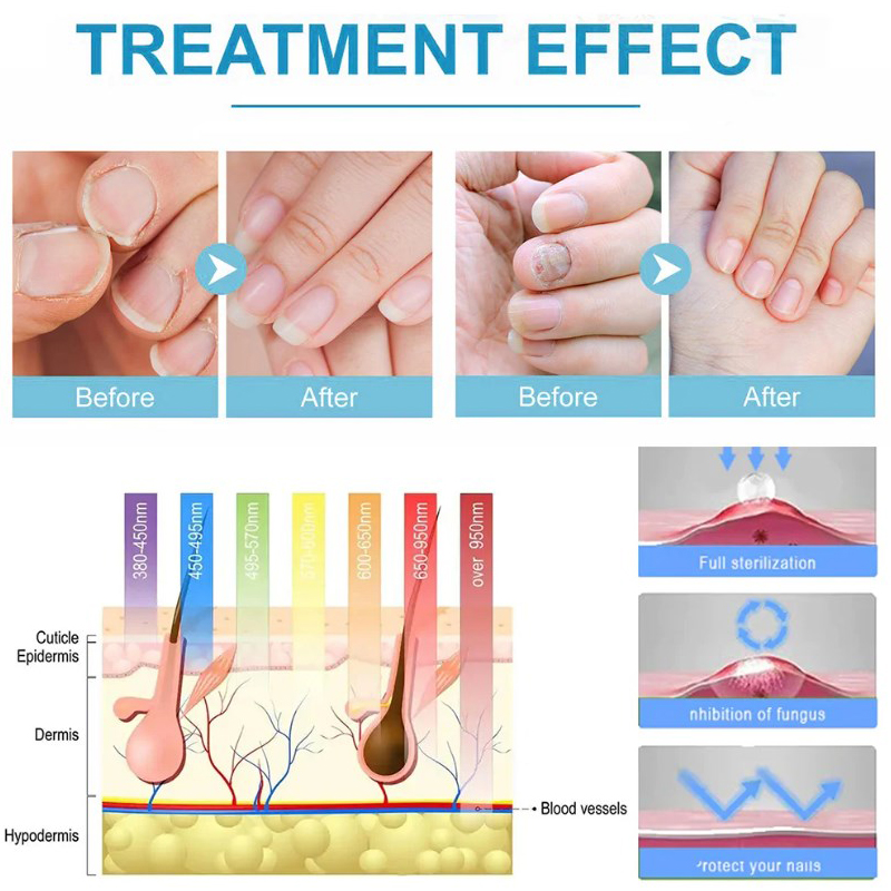High Frequency Facial Machine  - High Frequency Wand Facial Machine Neon 评论和价格