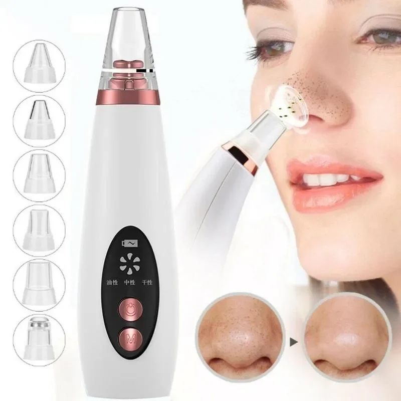 Blackhead Remover Vacuum Elect - Blackhead Remover Vacuum Suction 评论和价格