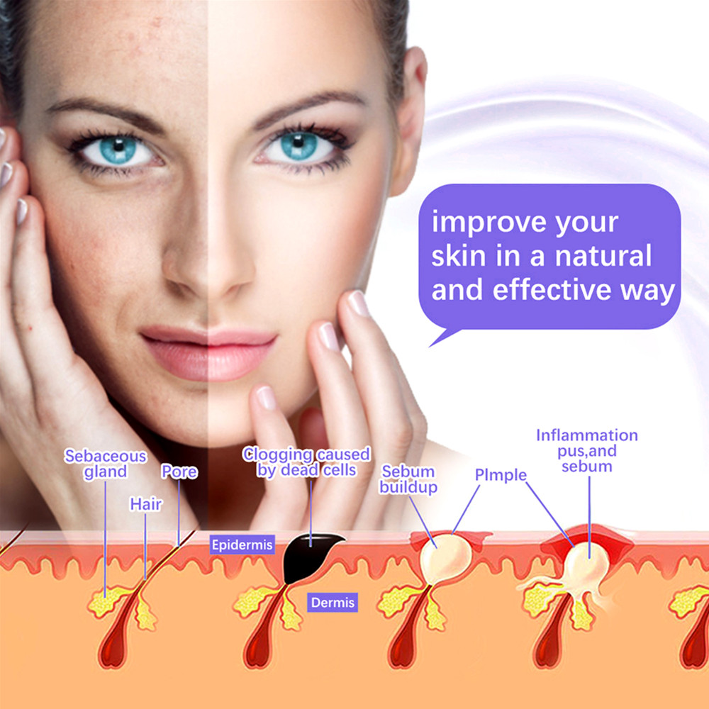 7 in 1 High Frequency Facial C - High Frequency Wand Facial Machine Neon 评论和价格